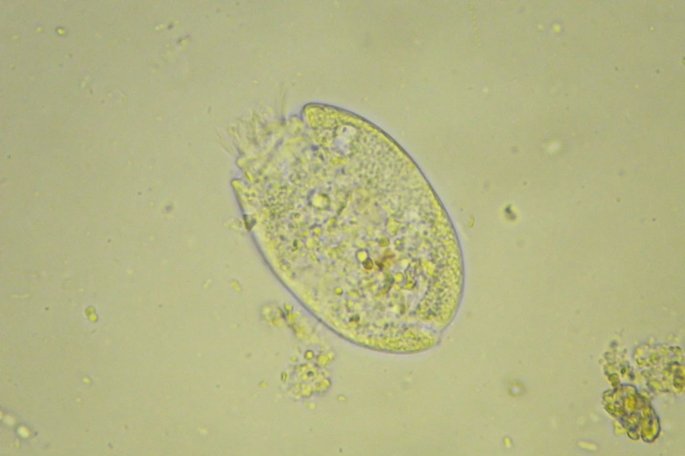 Image of a microorganism found in the rumen of cattle